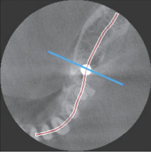 福岡市南区 歯科用CT 画像1
