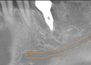 福岡市南区 歯科用CT 画像2